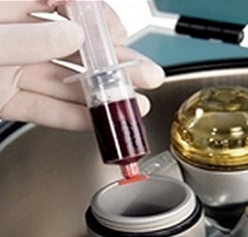 Medical Hair Regrowth Treatments Hair Loss Southampton Hampshire