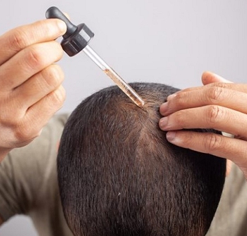 Medical Hair Regrowth Treatments Hair Loss Southampton Hampshire
